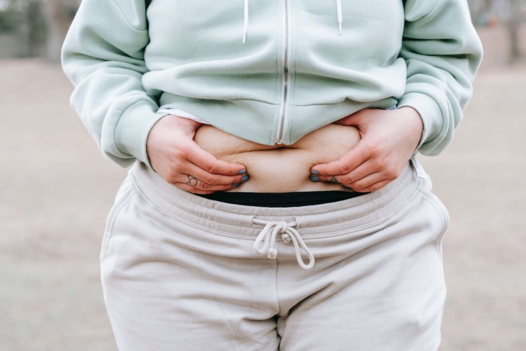 tummy tuck before and after - drsudhanva
