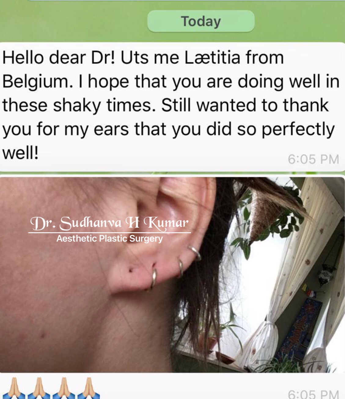 After earlobe repair review