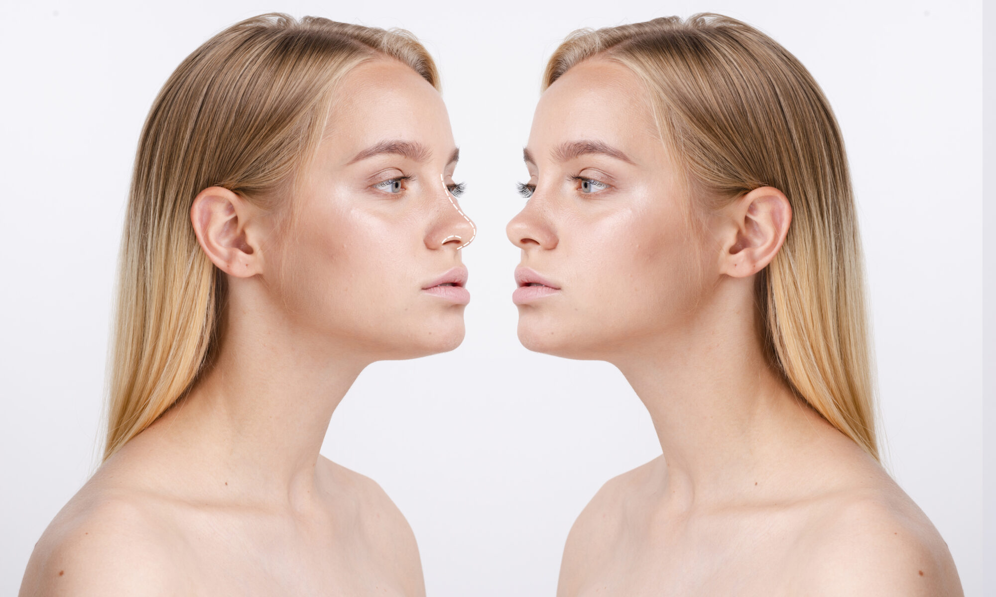 Rhinoplasty Surgery in Your 20s vs 40s