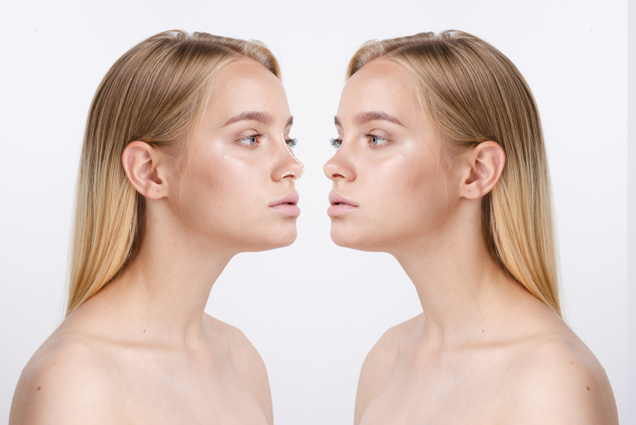 Rhinoplasty Surgery in Your 20s vs 40s: Key Considerations