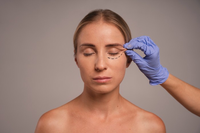 Woman preparing for cosmetic surgery