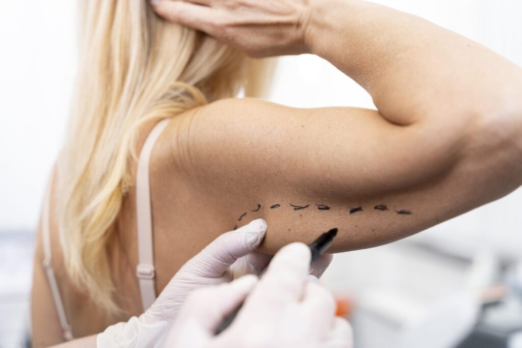 armlift