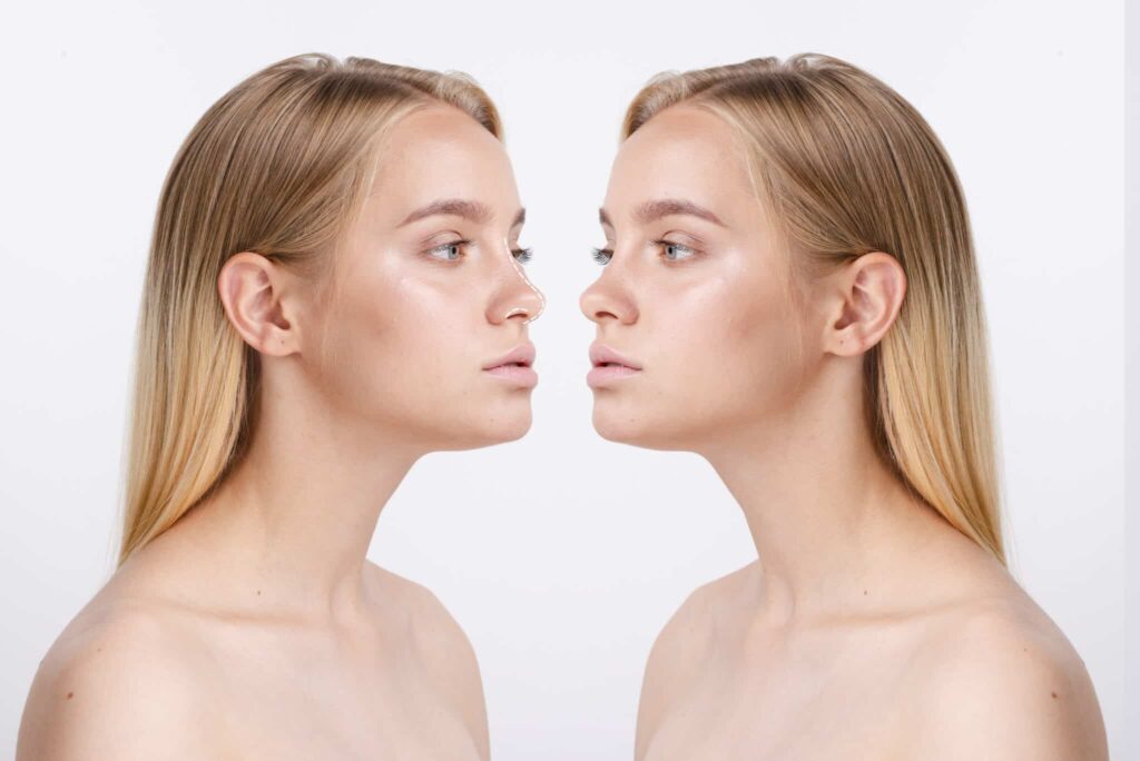 rhinoplasty surgery concept with woman model 2048x1367 1